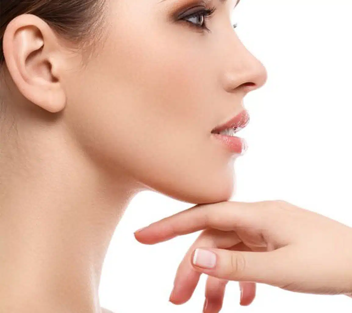 kybella kybella