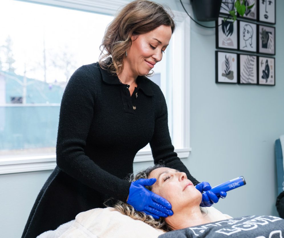 microneedling-1