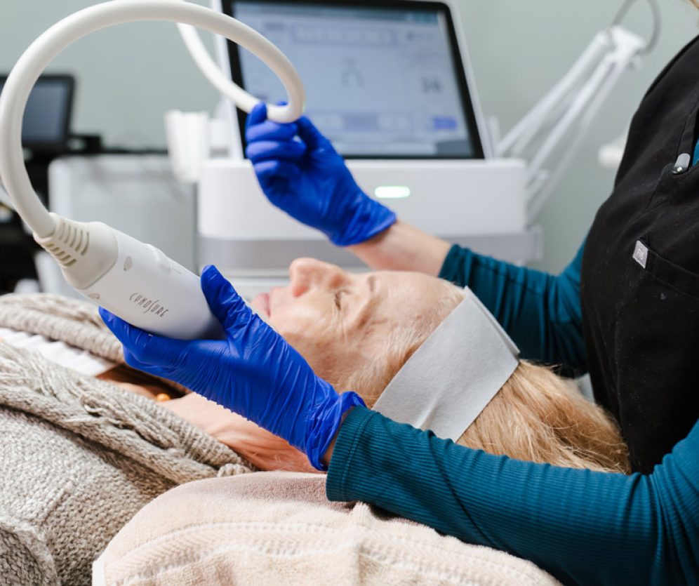 rf-microneedling-2